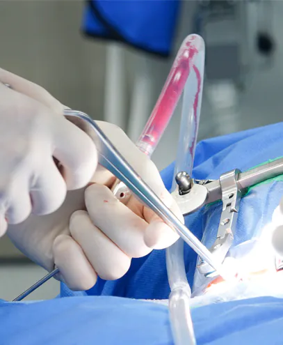 Polyisoprene surgical gloves used with precision medical instruments